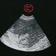 Sonogram